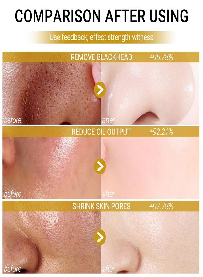 إريندي قناع الطين بالكركم من إيريندي، قطعتان، قناع تنظيف عميق بخلاصة نبات السنتيلا الآسيوية، قناع طيني منظف لتنظيف المسام بعمق، تحسين البشرة، قناع للوجه لعلاج حب الشباب، تقشير لطيف، والتحكم في إفراز الزيوت - Image 4